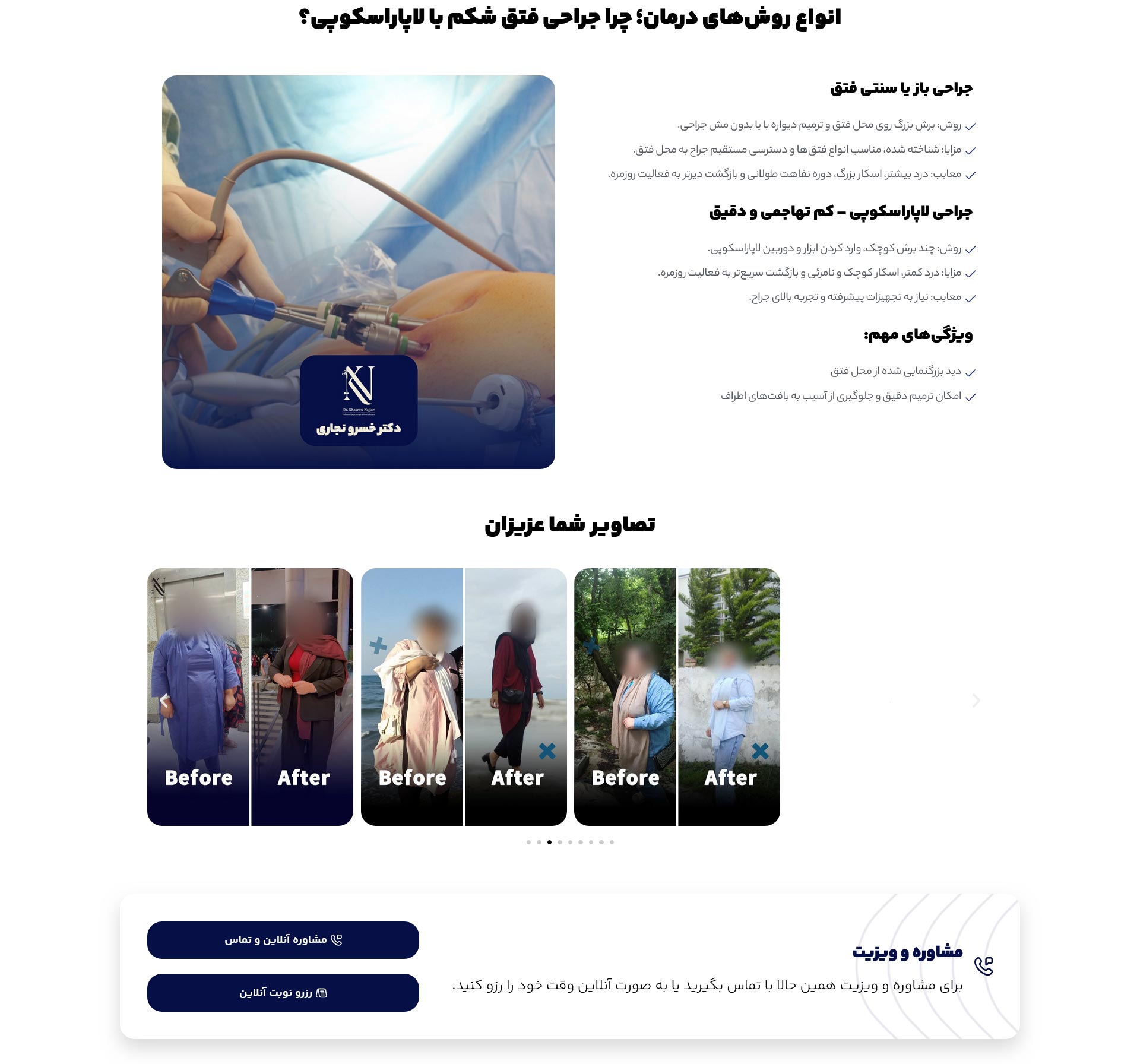 طراحی لندینگ عمل فتق شکم با لاپاراسکوپی